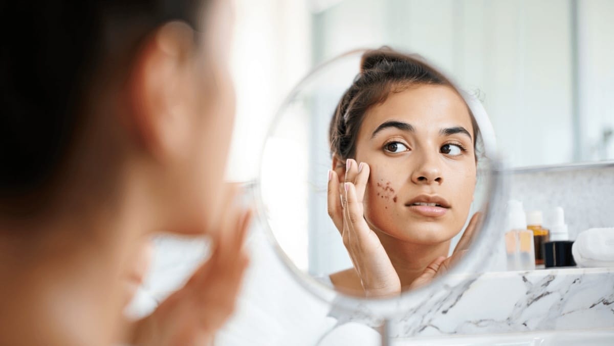 Dermatologie – 17 nov. 2023Cicatrices d’acné : comment s’en débarrasser ?Nos médecins généralistes et dermatologues vous disent tout sur les cicatrices d’acné et partagent avec vous les différentes options pour les traiter.En savoir plus