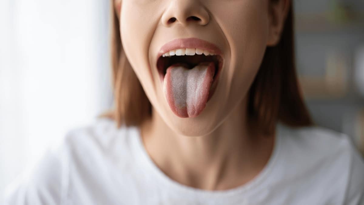 Médecine Générale – 12 sept. 2023Couleur langueLa couleur de notre langue peut en effet révéler de nombreuses informations sur notre état de santé. Nos médecins généralistes vous expliquent comment maintenir une langue saine.En savoir plus