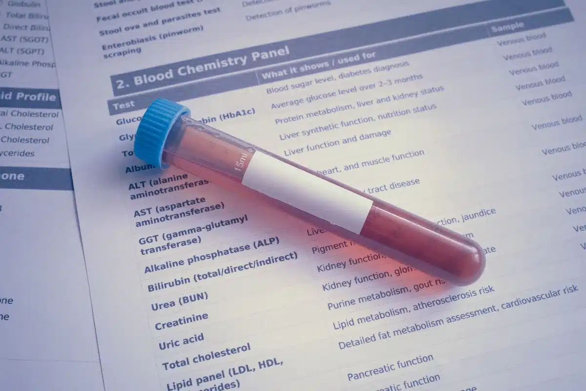 Professionnel de sant&eacute; effectuant une prise de sang pour d&eacute;pistage &agrave; 50 ans