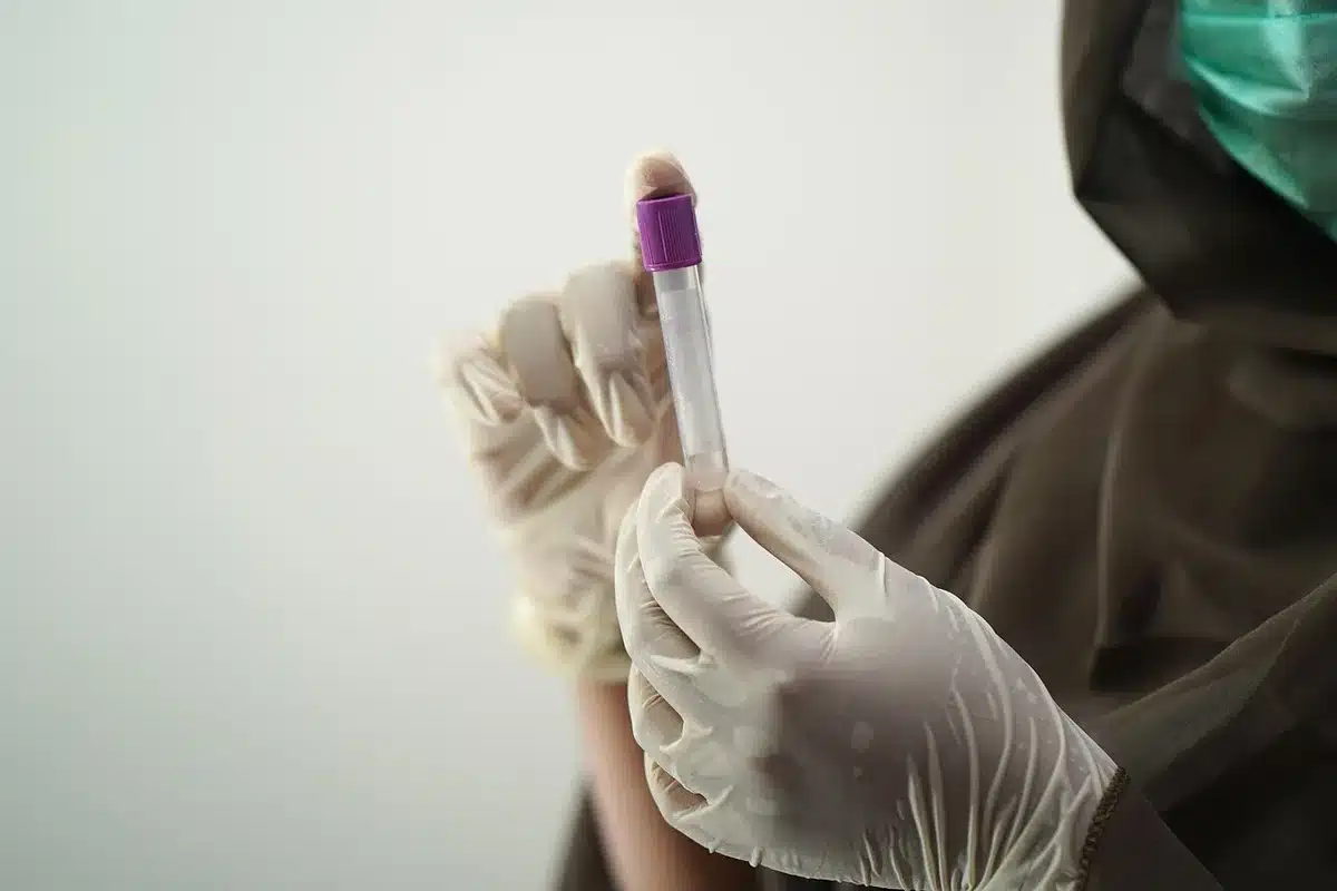 Pr&eacute;l&egrave;vement sanguin et tubes de laboratoire pour analyse hormonale