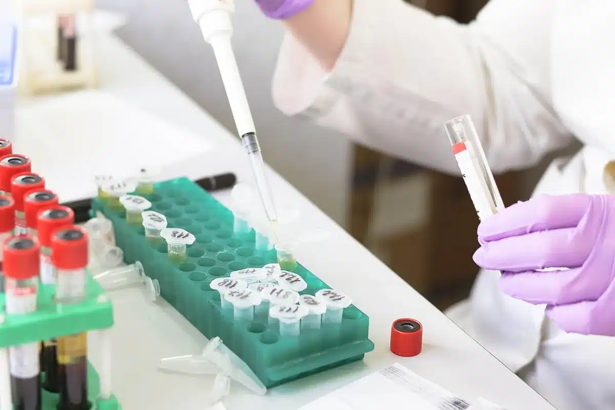 Technicien de laboratoire effectuant un test sanguin pour déterminer le groupe ABO
