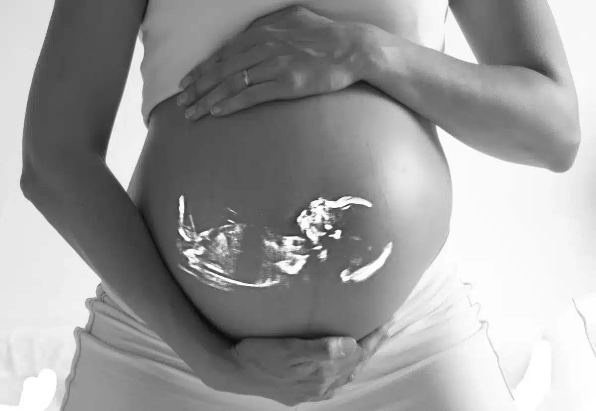 Femme enceinte lors d'une échographie prénatale de surveillance