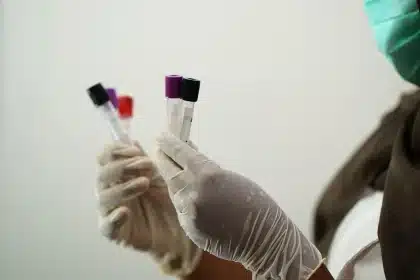Flacon de sang prélevé en laboratoire pour un test de groupe sanguin