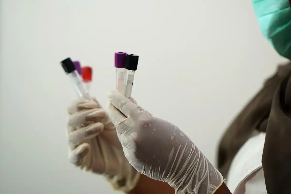 Flacon de sang prélevé en laboratoire pour un test de groupe sanguin