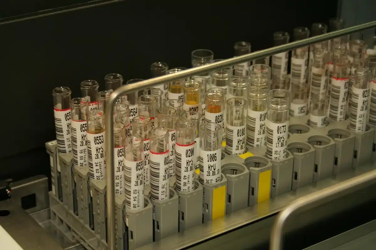 Prélèvement sanguin avec tube en laboratoire pour dosage des IgE